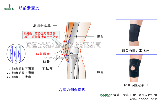 髕前滑囊炎膝關(guān)節(jié)滑囊炎的病因癥狀及防護(hù)與治療。膝關(guān)節(jié)滑囊的構(gòu)造與功能作用。博道膝關(guān)節(jié)透氣性加壓固定帶的功能與防護(hù)效果，醫(yī)用加壓護(hù)膝，滑囊炎專用加壓固定護(hù)膝，透氣性保暖保健護(hù)膝。右膝內(nèi)側(cè)側(cè)面觀膝關(guān)節(jié)的構(gòu)造。股四頭肌腱髕前滑囊髕韌帶髕前肌腱下滑囊髕前筋膜下滑囊髕前皮下滑囊。醫(yī)用護(hù)膝BK-1透氣性膝關(guān)節(jié)固定帶CL-1可調(diào)式膝關(guān)節(jié)卡盤(pán)固定支架矯形支具膝關(guān)節(jié)術(shù)后康復(fù)固定夾板膝關(guān)節(jié)共有11個(gè)滑囊是全身關(guān)節(jié)中滑囊