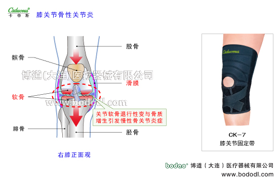 膝關(guān)節(jié)的運動損傷與防護(hù)