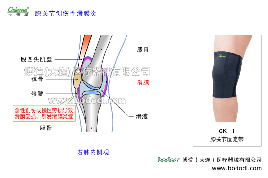 膝關(guān)節(jié)的運動損傷與防護(hù)
