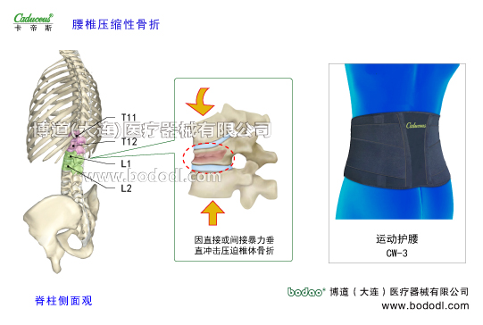 腰椎部的運動損傷與防護
