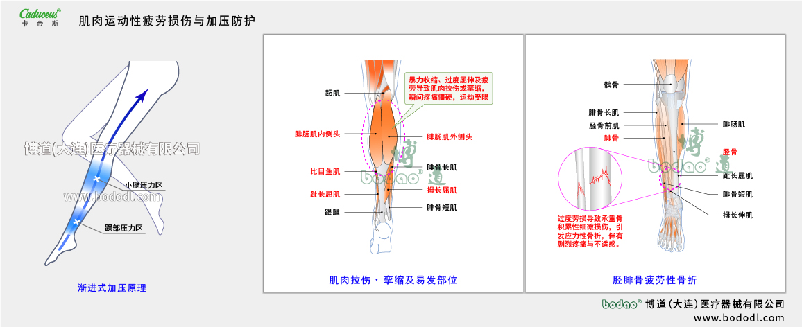 肌肉運(yùn)動性疲勞與運(yùn)動損傷
