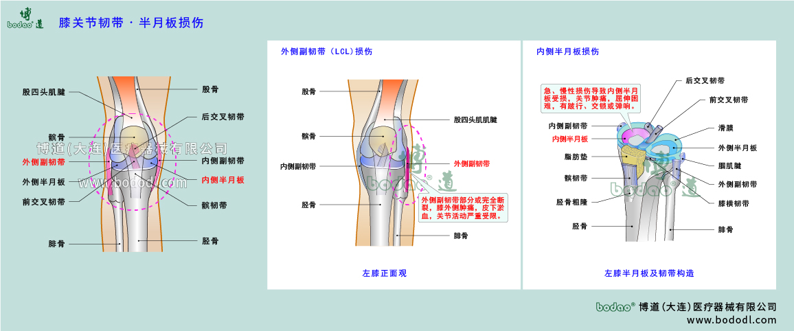 膝關(guān)節(jié)疾病的類型與癥狀