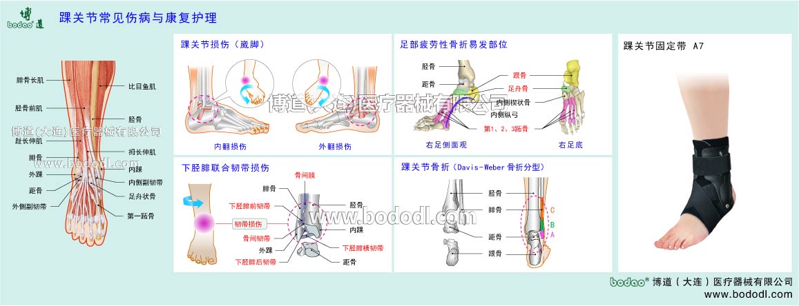 COMMON DISEASES OF ANKLE JOINT 