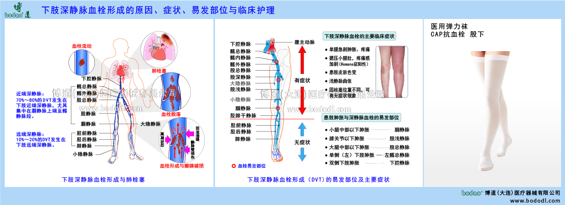 下肢深靜脈血栓形成與臨床護(hù)理